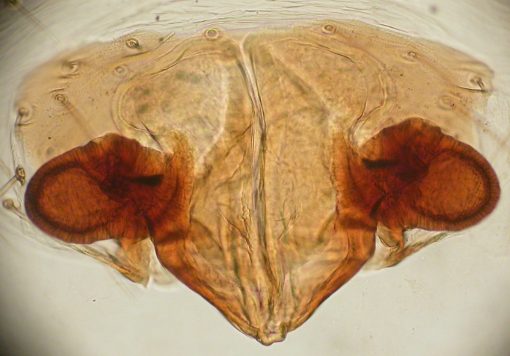 Datei:Entelecara congenera unterSteinamFlussufer Grimsbrua Folldal 11.145 vulva flach unterDeckglas AFjellberg.jpg