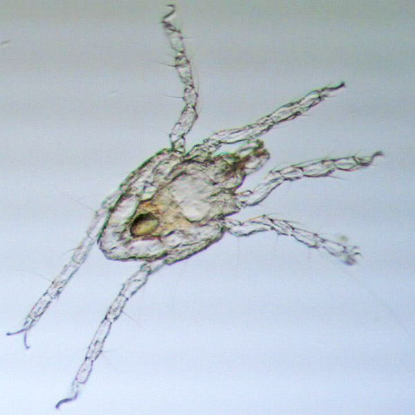DateiHalacaridae larva OS0001.jpg Wiki der Arachnologischen