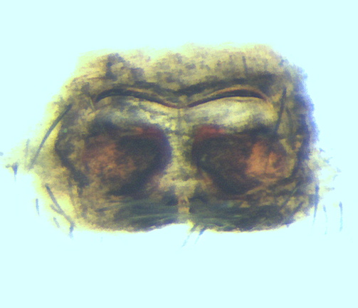 Datei:Micaria coarctata w epi 5,49mm Boden inVegetation StAndre FR Jul13 POger.jpg