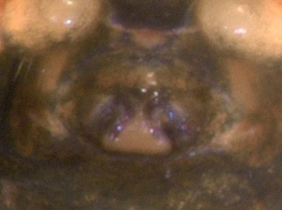 Datei:Trichopterna cito w epigyn nah 1,3mm anWasser GHMorka.jpg