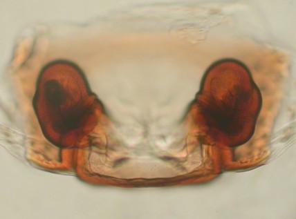 Datei:Thyreosthenius parasiticus w vulva Jarlsbergparken 07.11.2010 AFjellberg.jpg