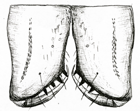 Datei:Centromerus arcanus chelicerer liten HLovbrekke.jpg
