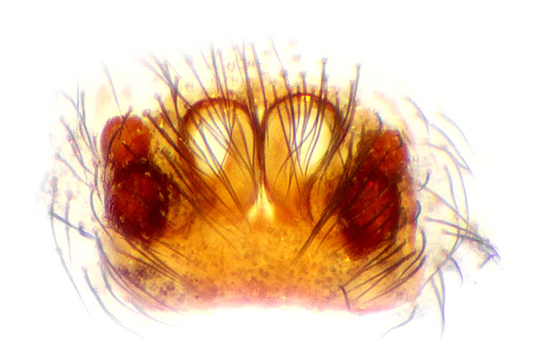 Datei:Pseudeuophrys obsoleta Epi Schaefer.jpg