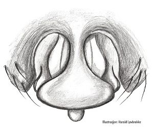 Datei:Tenuiphantes cristatus2 epigyn HLovbrekke.jpg