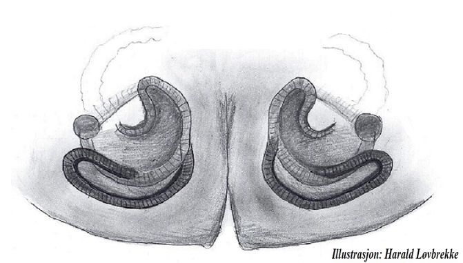 Datei:Erigonella hiemalis vulva dorsal HLovbrekke.jpg
