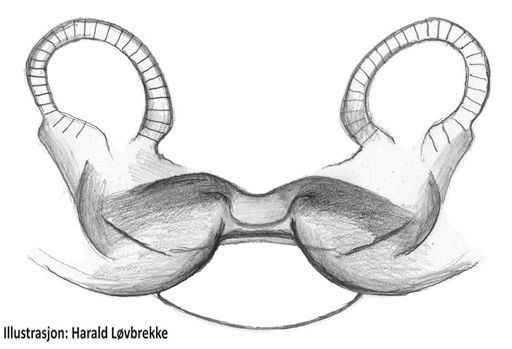 Datei:Semljicola alticola vulva ventral HLovbrekke.jpg