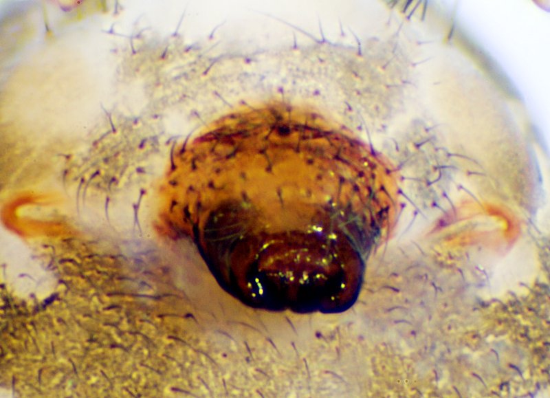 Datei:Hilaira herniosa f Finnmark-29.07.11-122-0 epigyne-1.jpg