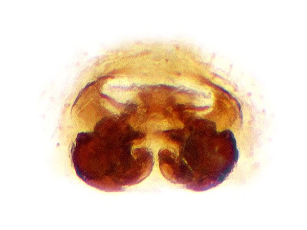 Datei:Bianor albobimaculatus Vulva Sa.jpg