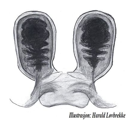 Datei:Stemonyphantes lineatus vulva dorsalt HLovbrekke.jpg