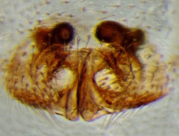 Datei:Dicymbium nigrum brevistosum 2014-03-28 Timmendorferstrand f Epigyne praep geaetzt.jpg
