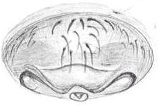 Datei:Meioneta mossica & saxatilis Epigyne HLoevbrekke.jpg