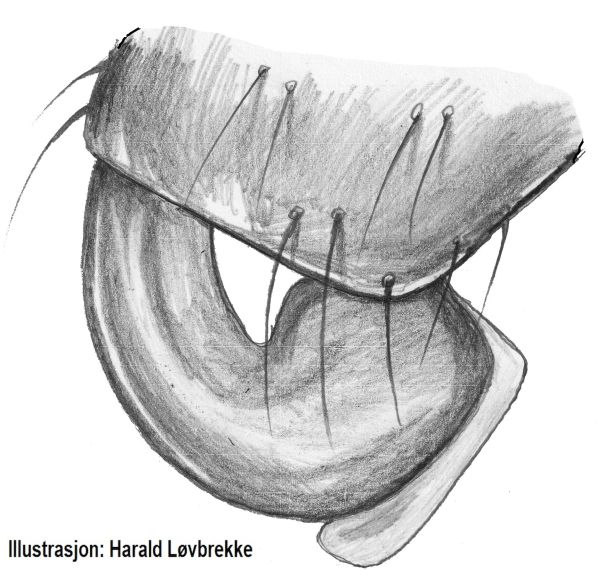 Datei:Mughiphantes whymperi epigynela 3 HLovbrekke.jpg