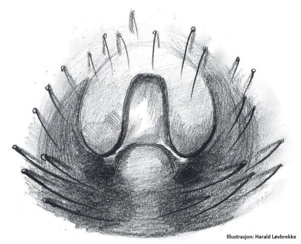 Datei:Sibianor larae Epigyn HLovbrekke.jpg