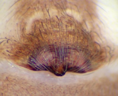 Datei:Clubiona reclusa f (epi ventral)-19.05.10-428-0.jpg