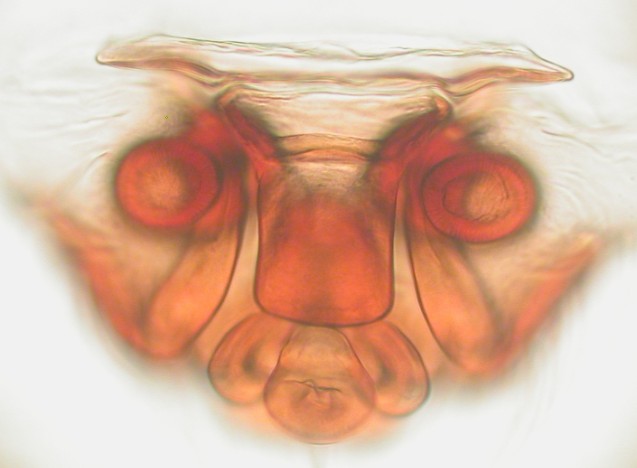 Datei:Centromerus brevivulvatus Mågerø 14.11.2010 vulva AFjellberg.jpg