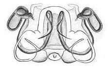 Datei:Meioneta mossica vulva HLoevbrekke.jpg