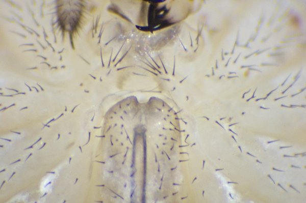 Datei:Parologoglophus agrestis fem ventral.jpg
