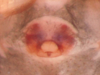 Datei:P1011556 epigyn porrhomma montanum 180510-350.jpg