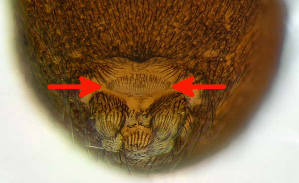 Datei:Argenna subnigra 2014-04-01 DU f Spinnapparat Cribellum markiert.jpg
