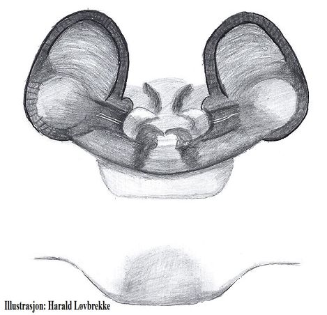 Datei:Robertus lyrifer vulva dorsal HLovbrekke.jpg