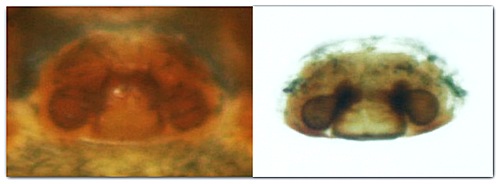 Datei:Troxochrata scabra w epigyn vulva 1,9mm Dez2010 MFarlund.jpg