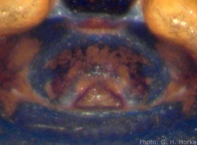 Datei:Pelecopsis elongata epigyn 400 GHMorka.jpg