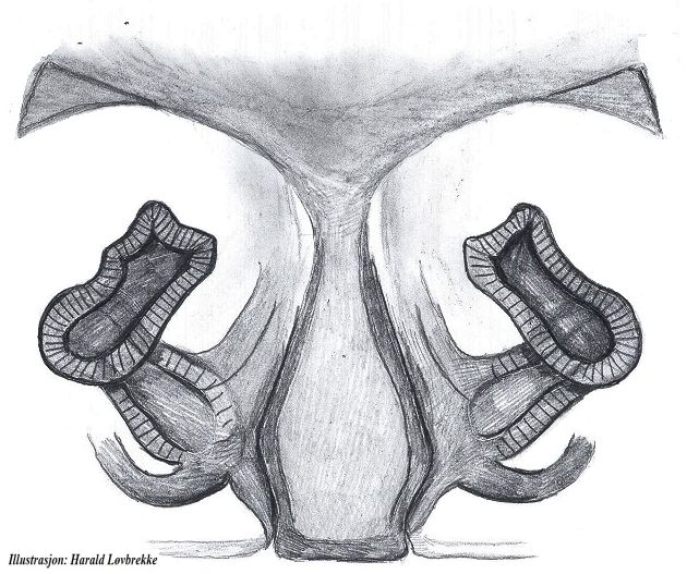 Datei:Pardosa fulvipes vulva do HLovbrekke.jpg