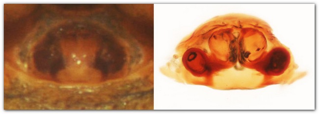 Datei:Pelecopsis radicicola epigyn-vulva MFarlund.jpg
