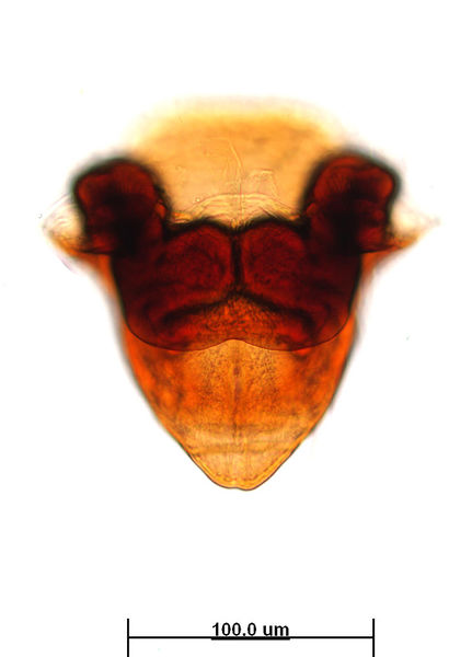 Datei:Tibioplus diversus female A6008 O3005.jpg
