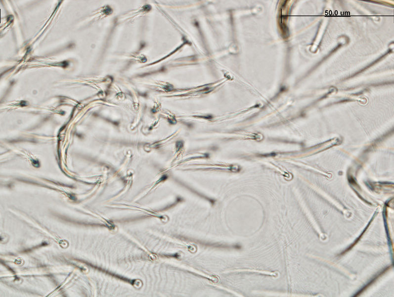 Datei:Balaustium sp A6715 O5064.jpg