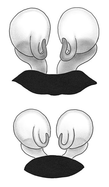 Datei:Enoplognatha-thoracica Vulva.jpg