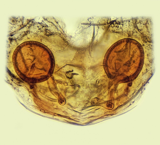 Datei:Iberina difficilis Vulva 20180111181717-6ba6d59e-me.jpg