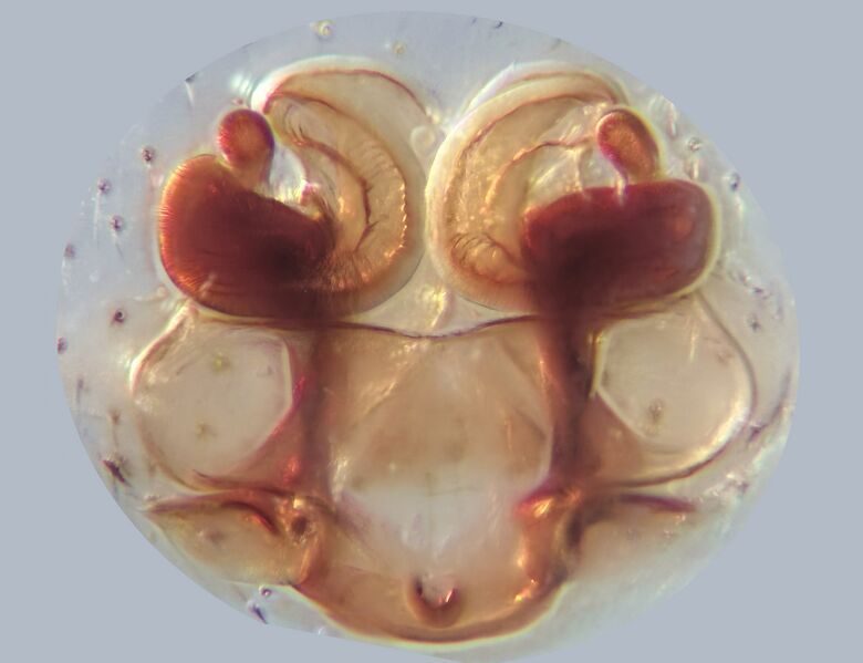 Datei:Porrhomma microps-CML 09773-Vulva.jpg