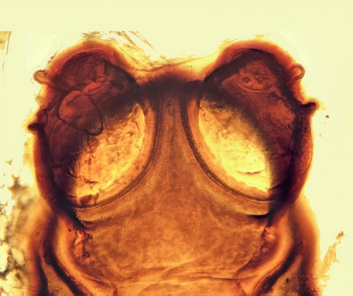 Datei:Drassodex fritillifer Vulva 20170921113750-bad09cd3-me.jpg