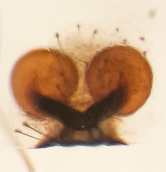 Datei:Enoplognatha quadripunctata f vulva ventral.jpg