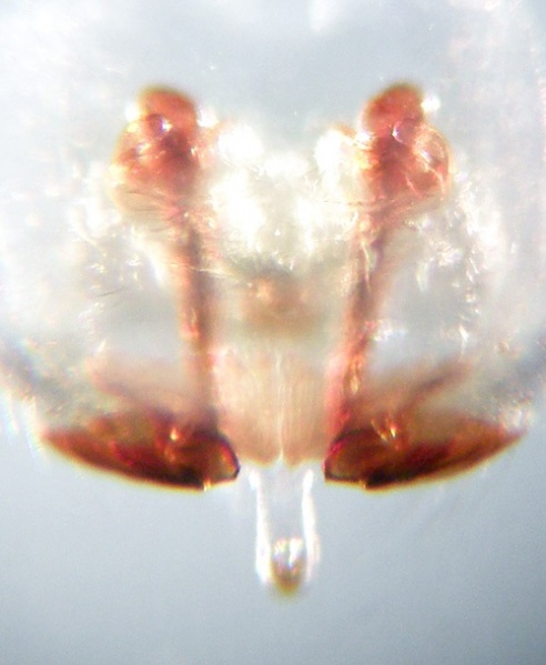 Datei:Bathyphantes nigrinus vulva GHMorka.jpg