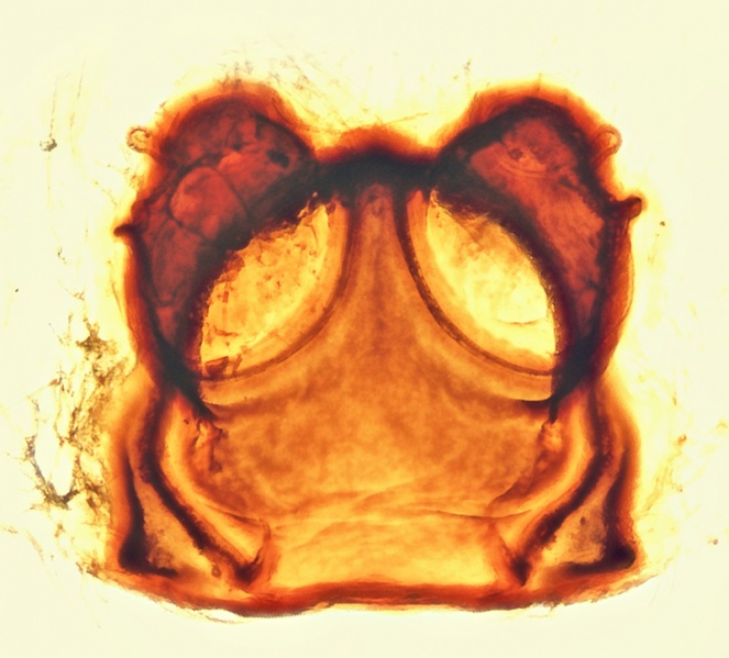 Datei:Drassodex fritillifer Vulva 20170921113749-b3a6f76e.jpg