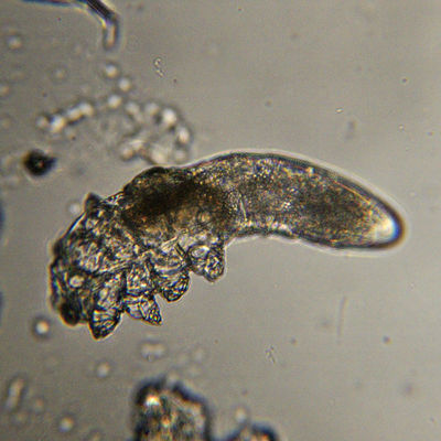Demodex brevis PI4674.JPG