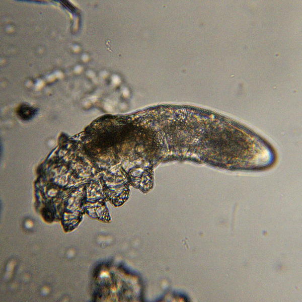 Datei:Demodex brevis PI4674.JPG
