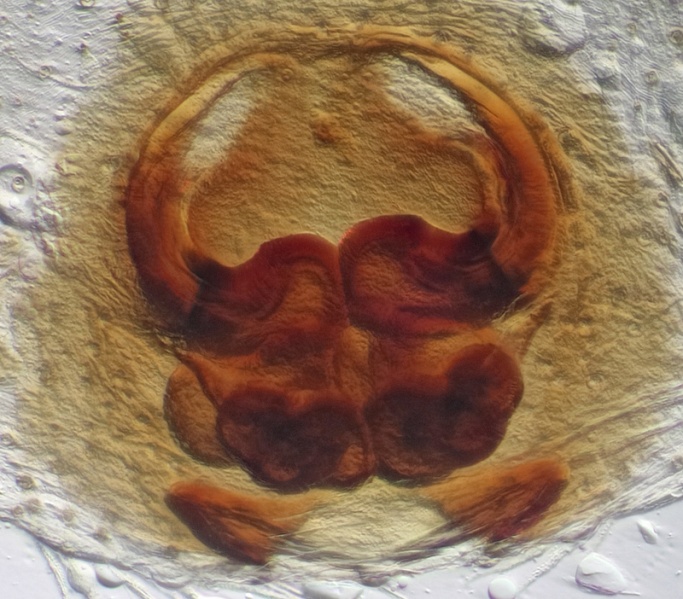 Datei:Dendryphantes rudis Vulva STEk.jpg