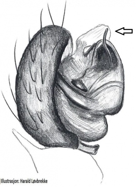 Datei:Troxochrota scabra palp prrolateralt HLovbrekke.jpg