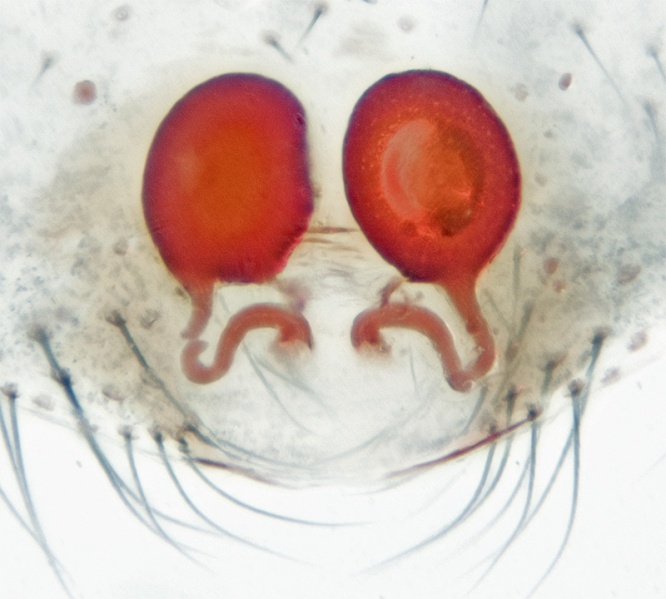 Datei:Theridion betteni Lauterhofen-Oberpfalz-Vulva-.jpeg