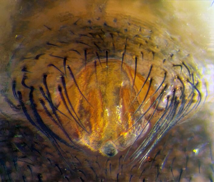 Datei:Lepthyphantes-minutus Epigyne.jpg