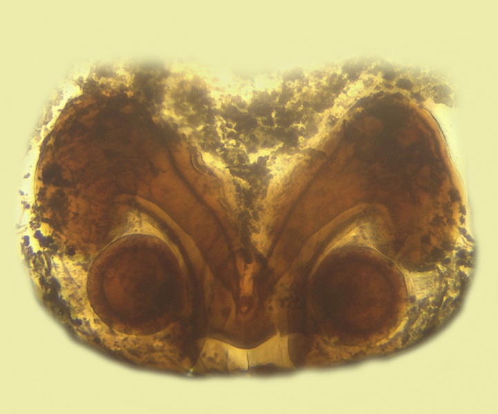 Datei:Typhochrestus simoni Epigyne 20140114165731-24165135-me.jpg