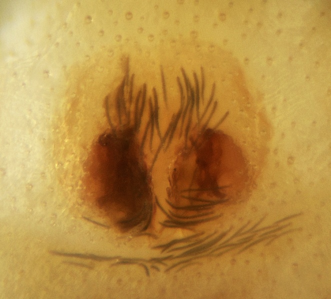 Datei:Apostenus humilis Epigyne 20171218210028-cc762725.jpg