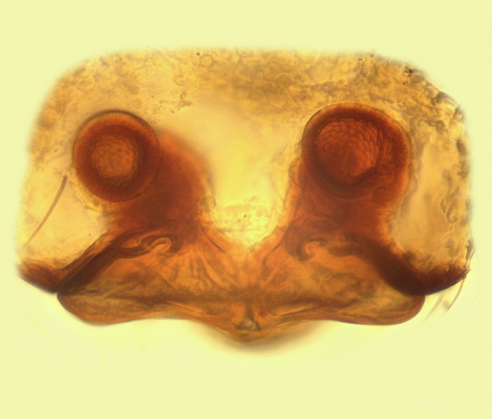 Datei:Walckenaeria dalmasi Vulva 20140218125234-2a93f5f0-me.jpg