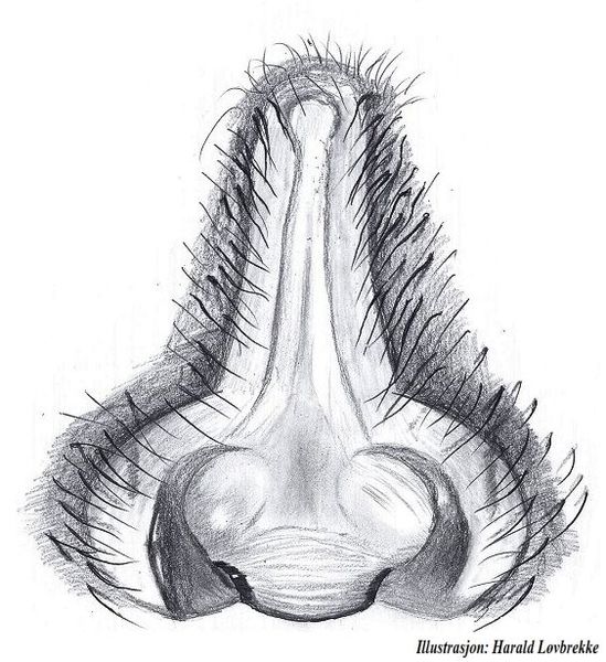 Datei:Pardosa eiseni epigyn HLovbrekke.jpg