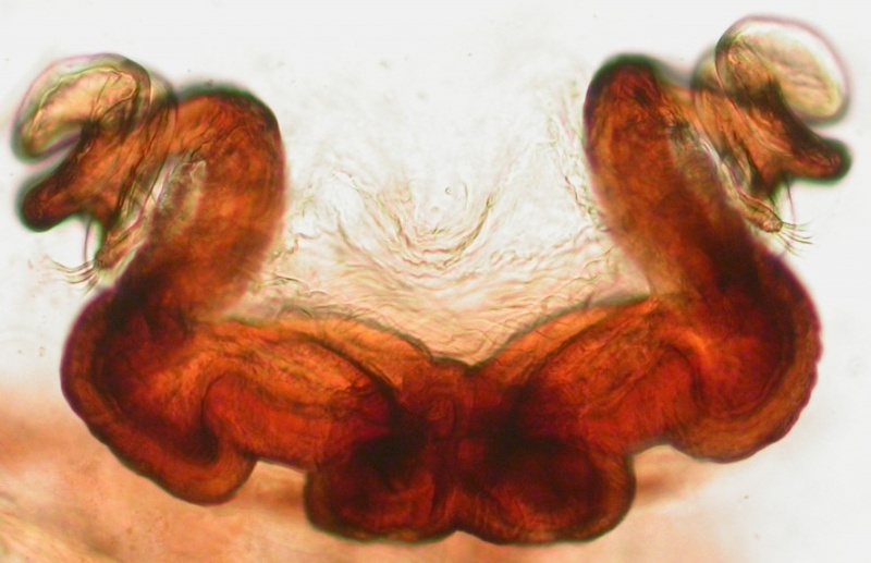 Datei:Dictyna palmgreni vulva Arne Fjellberg.jpg