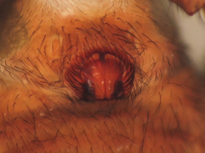 Datei:Epigyne etrusca.jpg