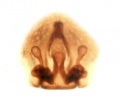 Vulva